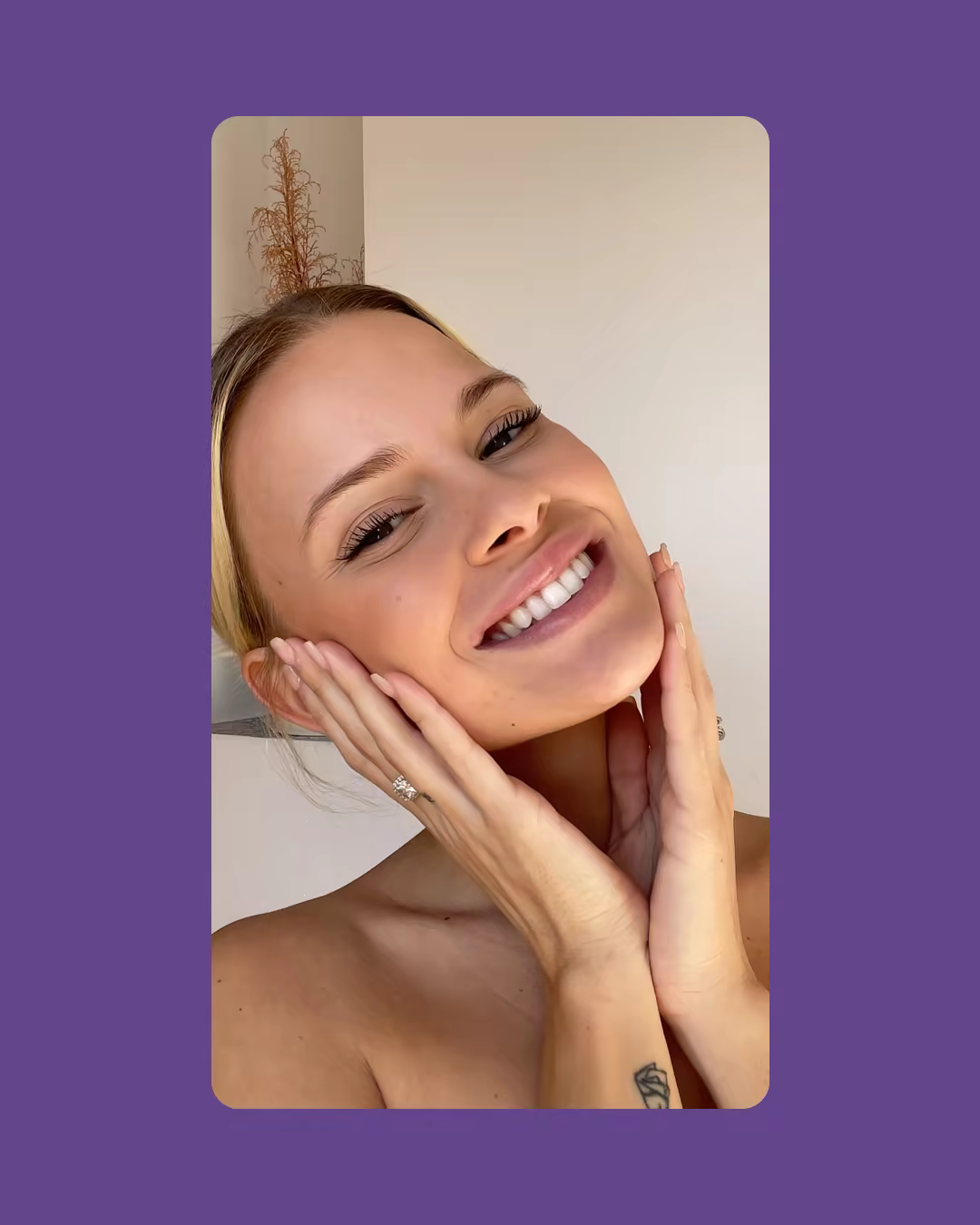 Smirk teeth whitening DTC